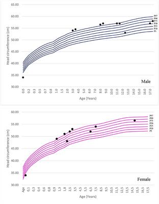 Neurological, neurobehavioral, and radiological alterations in patients with mucopolysaccharidosis III (Sanfilippo's syndrome) in Brazil